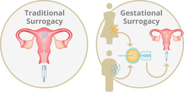 🤱 surrogacy in india – common myths & facts every couple should know 5 Traditional surrogacy vs gestational surrogacy