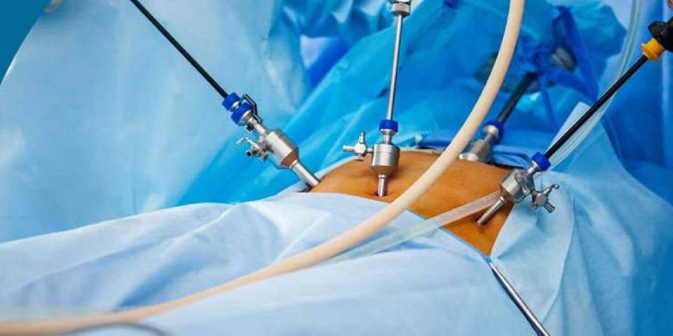Surgeon performing laparoscopy surgery with advanced minimally invasive equipment at ayuh fertility centre.
