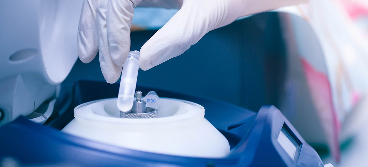 Gloved hand operating cryopreservation equipment at an art bank for safe storage of donor eggs, sperm, and embryos at ayuh fertility centre.